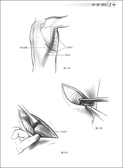 胸外科手术图谱(翻译版)-markk.ferguson