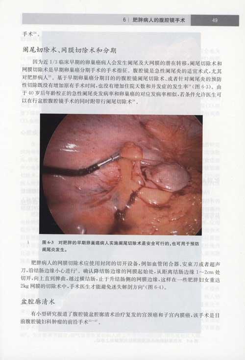 妇科肿瘤腹腔镜手术心包疾病-(加)卡文-妇产科学-文