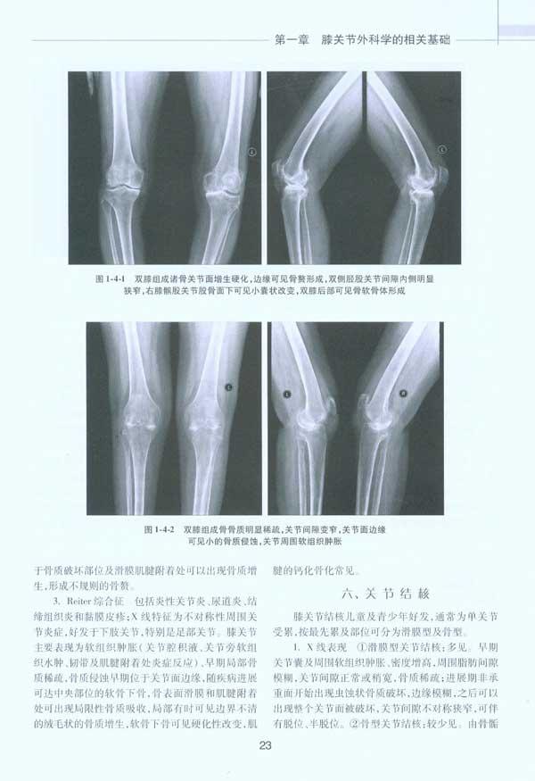 膝关节外科学-吕厚山-外科学