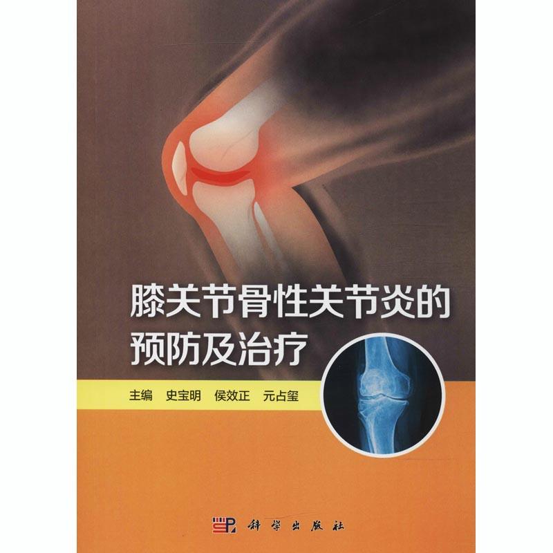  膝关节骨性关节炎的预防及治疗 