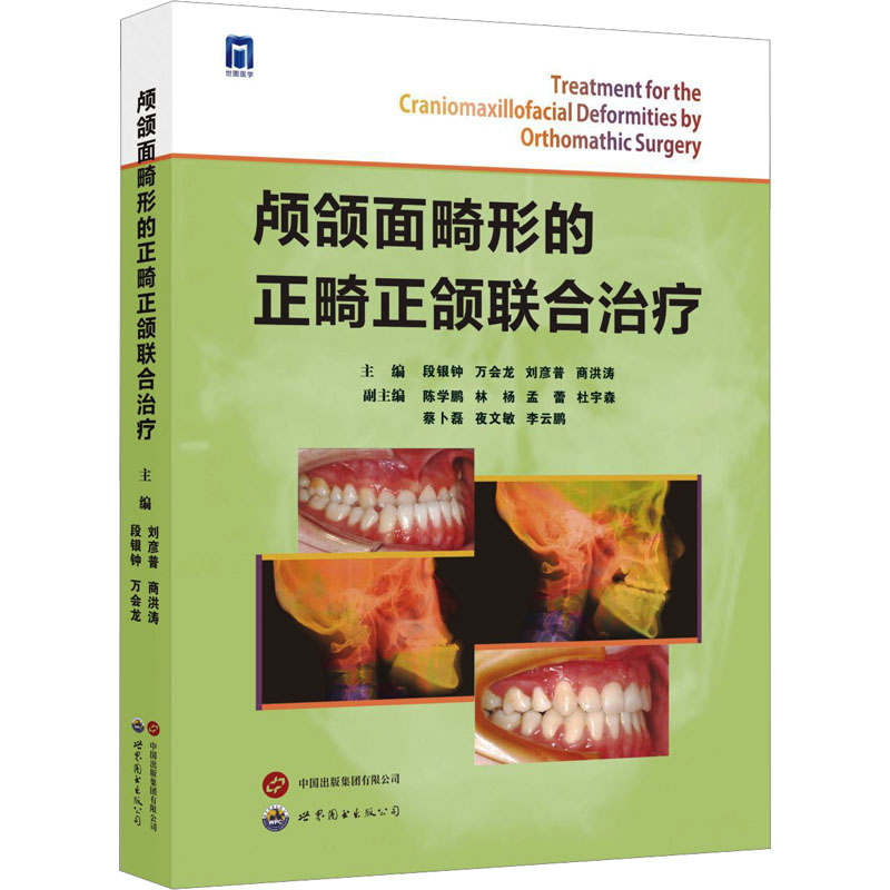 颅颌面畸形的正畸正颌联合治疗 