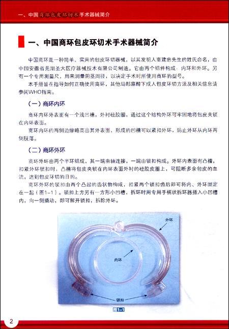 欧式环切术前图片,欧式环切术每天恢复图,欧式环切术恢复图片_大山谷图库