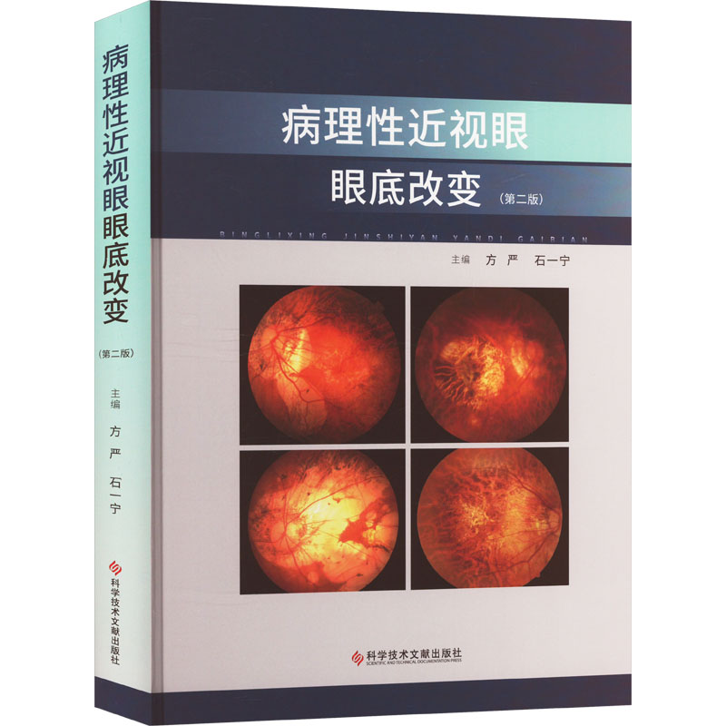  病理性近视眼眼底改变(第2版) 