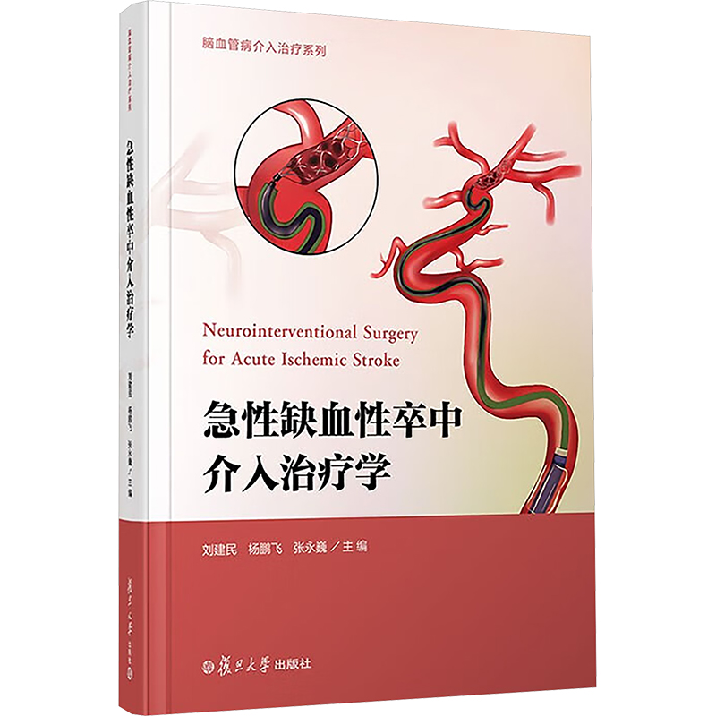  急性缺血性卒中介入治疗学 